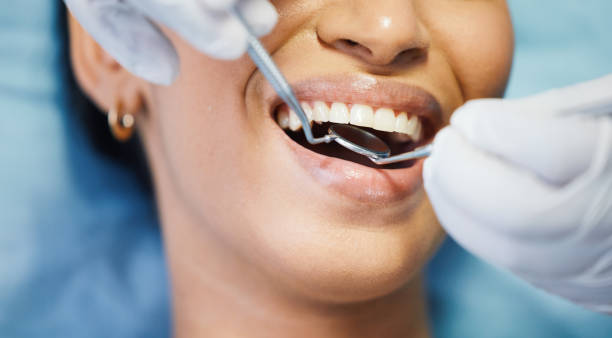 Best Urgent Care for Lost Fillings or Crowns in Tehachapi, CA