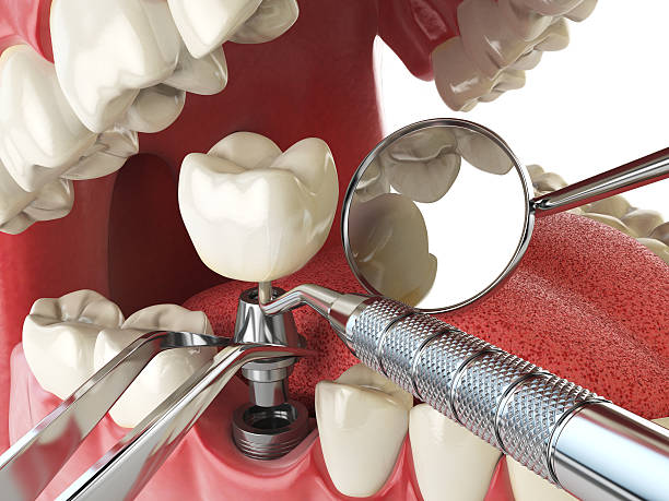 Best Emergency TMJ Treatment in Tehachapi, CA